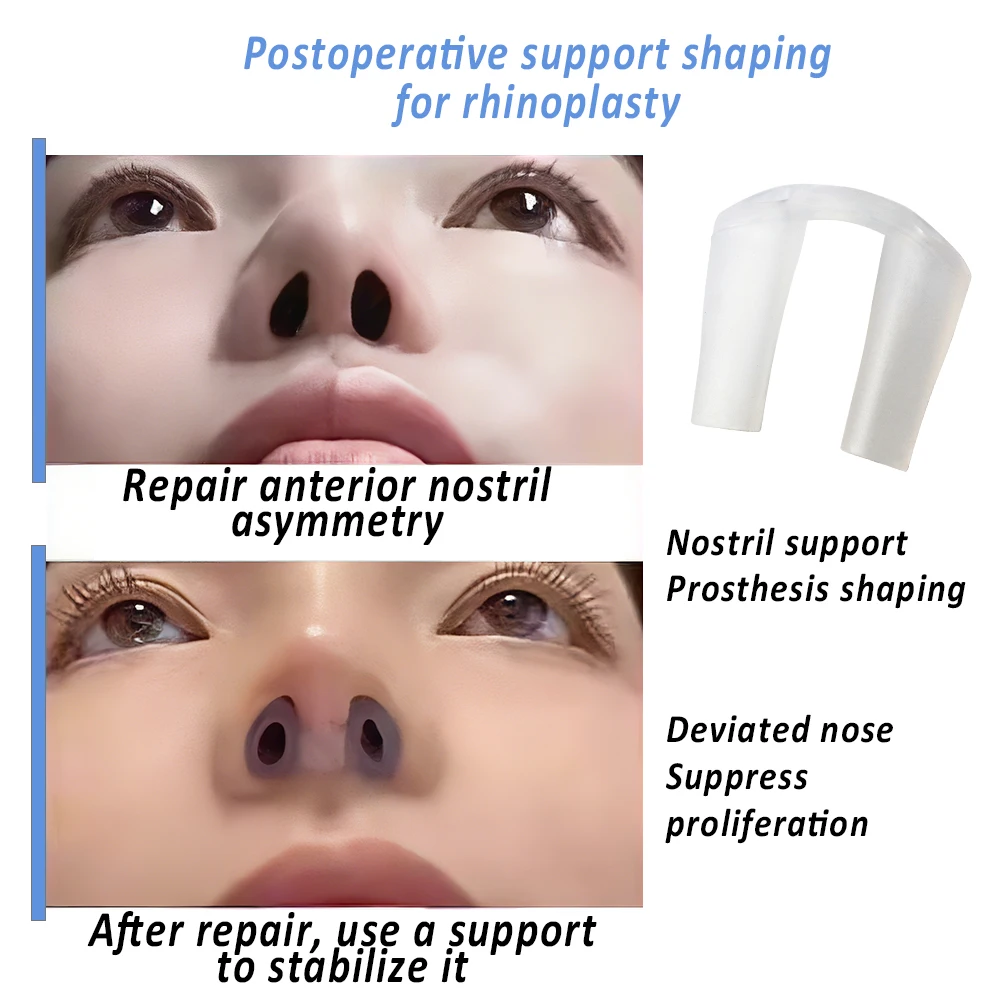 Postoperative Rhinoplasty Nost - Anti Snore Contour Pillow ulasan dan harga